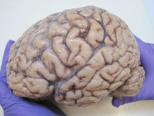 Lobotomy Simulator